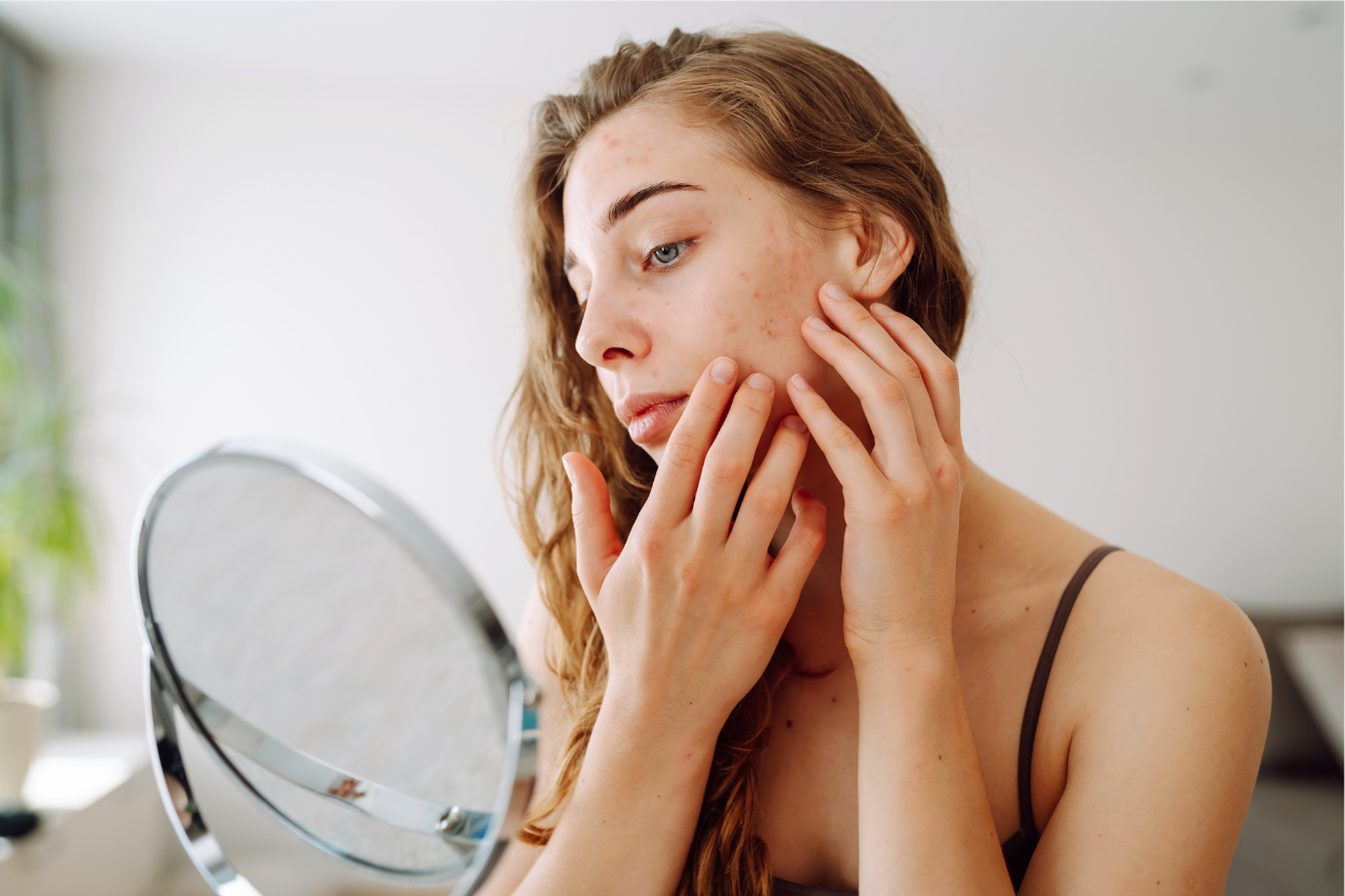 10 Tips To Fix Stubborn Dry Skin