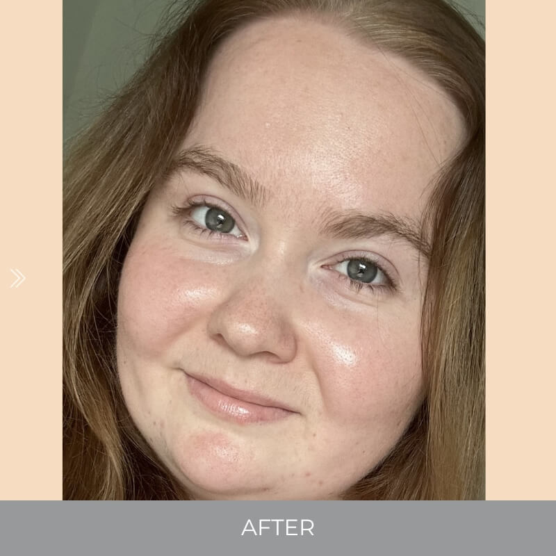 Close-up of a person with 'AFTER' text, indicating a before-and-after comparison.